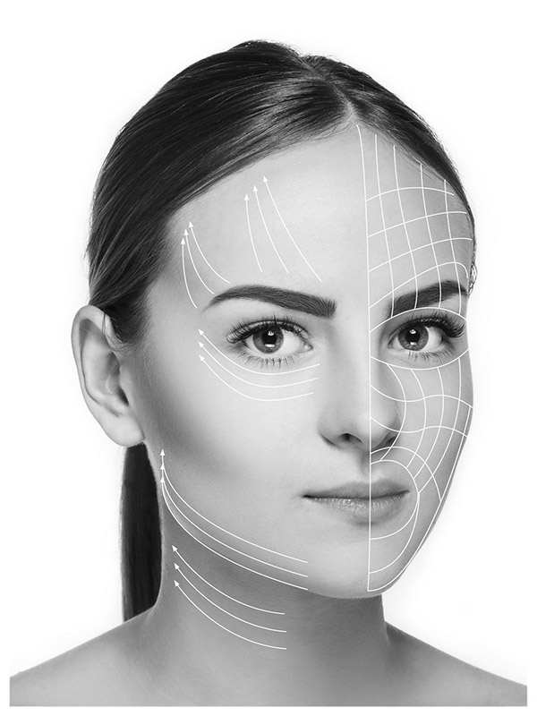 A Womans Face with Illustration of Facelift Surgical Lines.