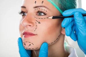 Awake Facelift Patient Being Marked Before Surgery