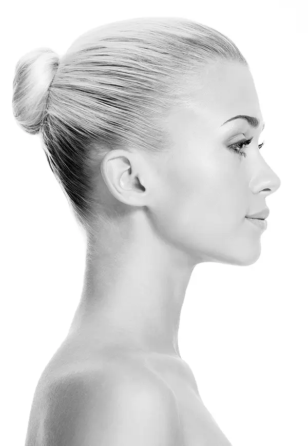Perfect Side Profile of Non-Surgical Rhinoplasty